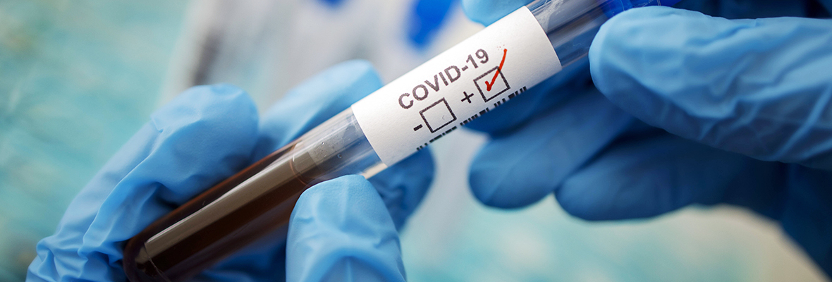 коронавирус