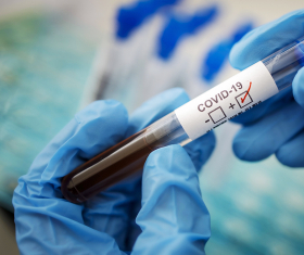 коронавирус